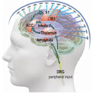 tFUS is used to target the brain's pain-processing circuits and modify the functional activity of specific brain targets