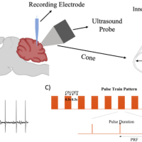 Figure 1: visual representation of the experimental setup and demonstrates the steps involved in recording and stimulating neural activity in the cerebellar cortex of rats using transcranial ultrasound [8].